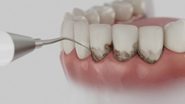 Trusted Invisalign Clear Aligners service in Glasgow, KY - Dentist Open Now